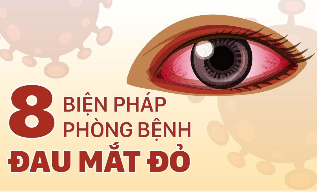 BỆNH ĐAU MẮT ĐỎ ĐANG GIA TĂNG, CẦN PHẢI LÀM GÌ ĐỂ PHÒNG BỆNH?