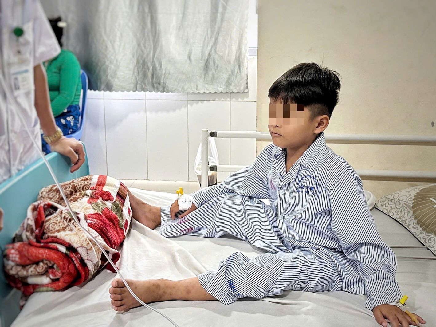 [TIN BÁO CHÍ] PHẪU THUẬT THÀNH CÔNG BÉ TRAI 6 TUỔI NUỐT NAM CHÂM GÂY THỦNG RUỘT