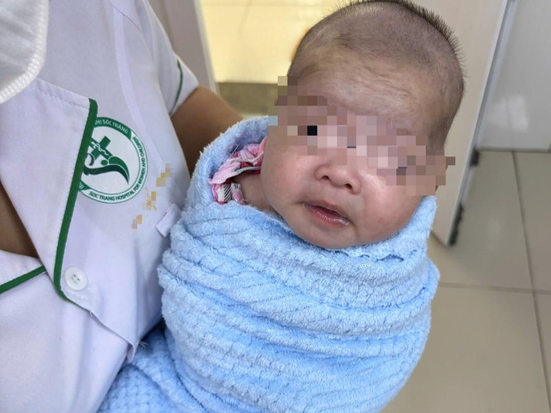 [TIN BÁO CHÍ] TRẺ SƠ SINH 8 NGÀY TUỔI BỊ UỐN VÁN NẶNG